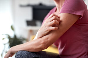 close up of a man scratching at his arm as he asks, what are meth sores?